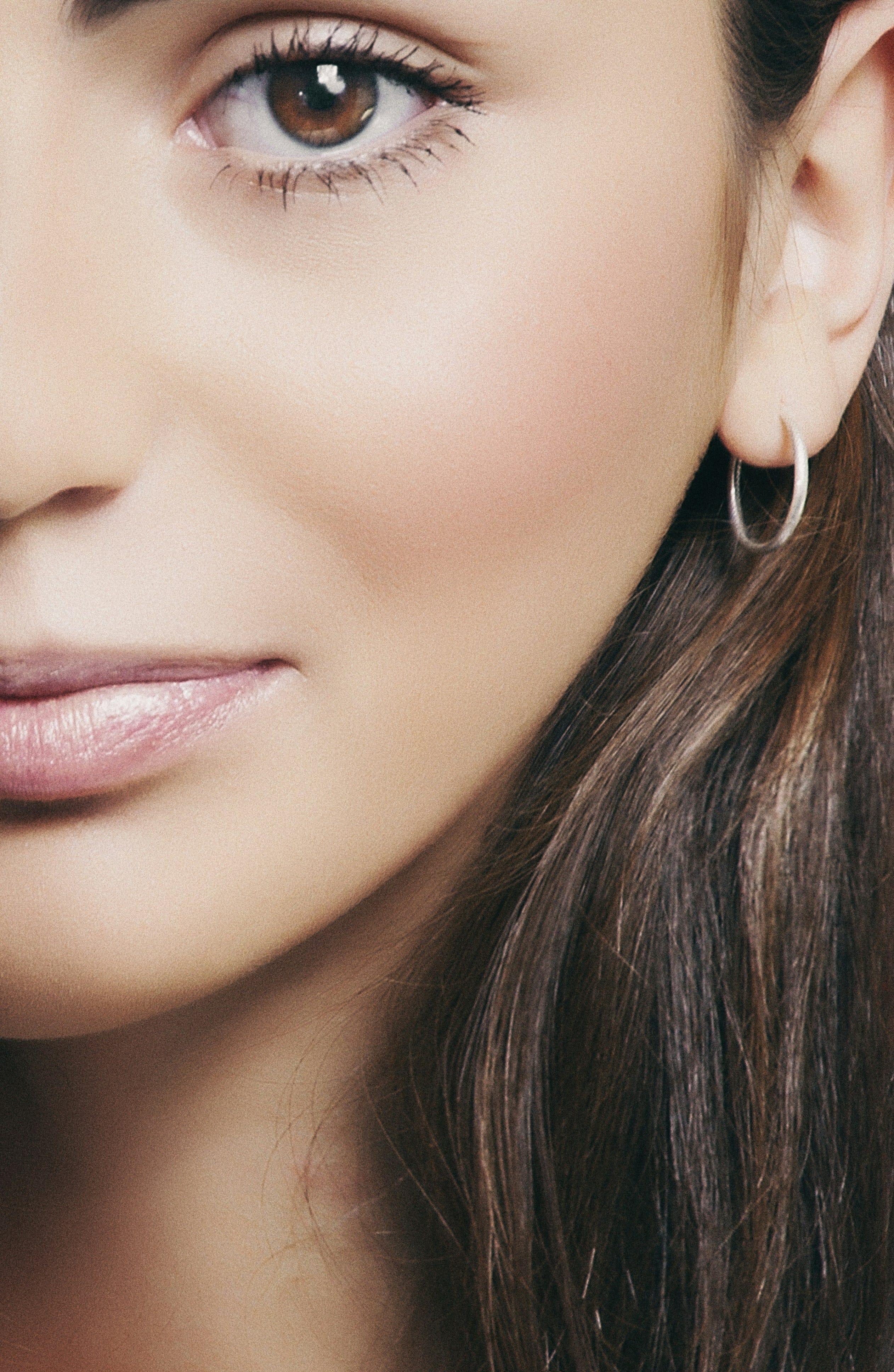 Dermal filler Treatment